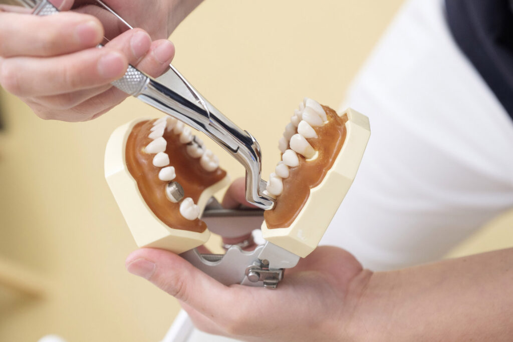 tooth extraction in Singapore