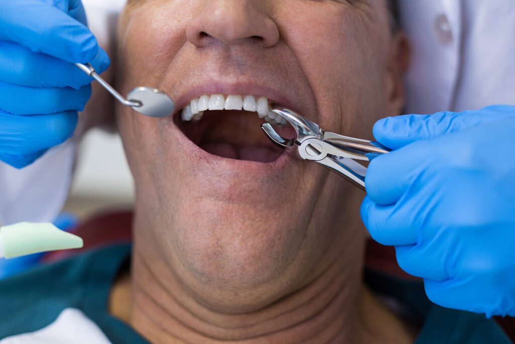 tooth extraction recovery