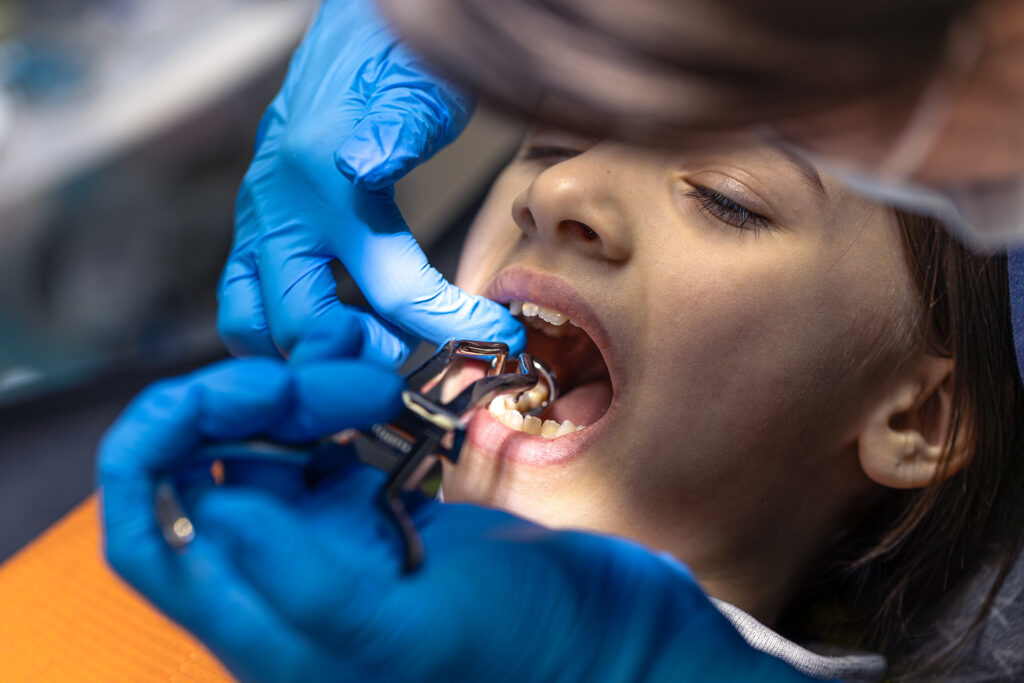 what can I eat after a tooth extraction
