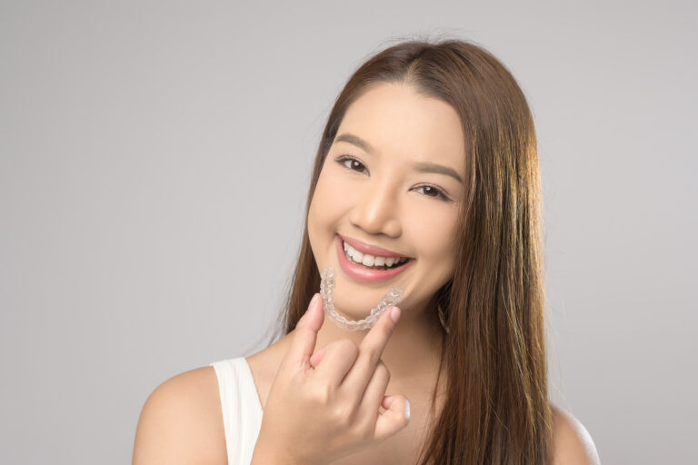 aligners vs braces