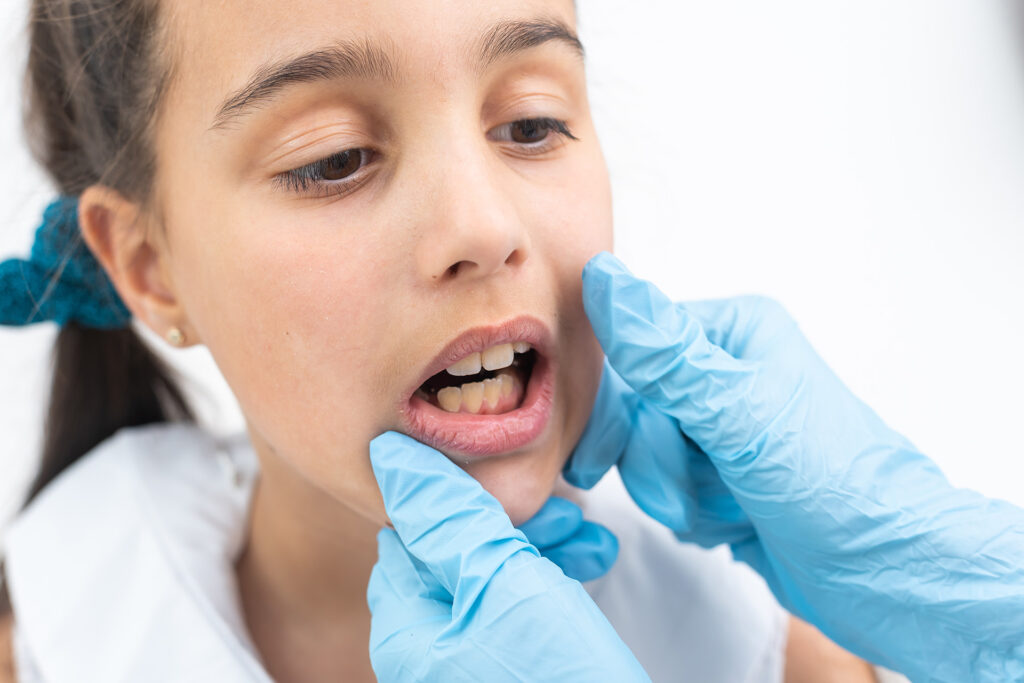 clenching teeth while awake
