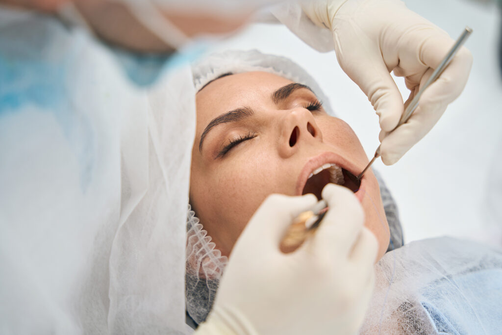 composite bonding veneers