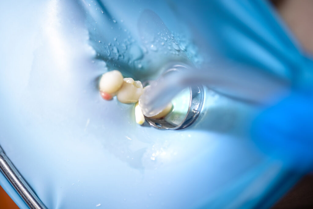 how-to-know-if-wisdom-tooth-infected