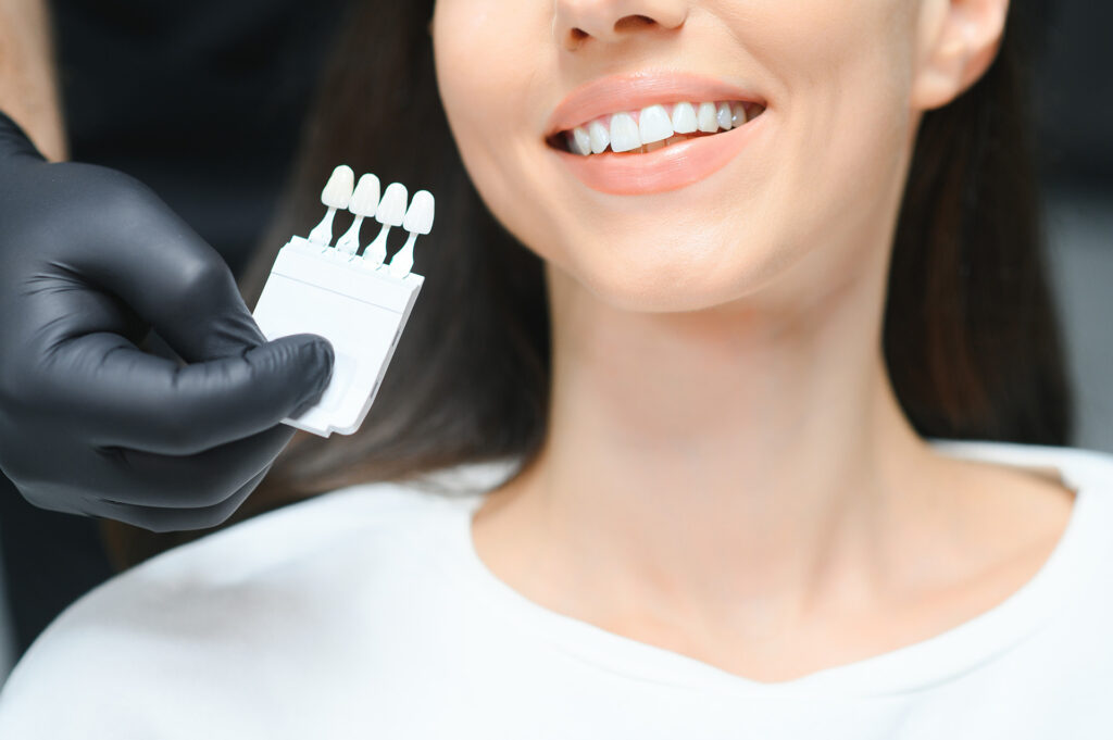 teeth whitening take home kit Singapore