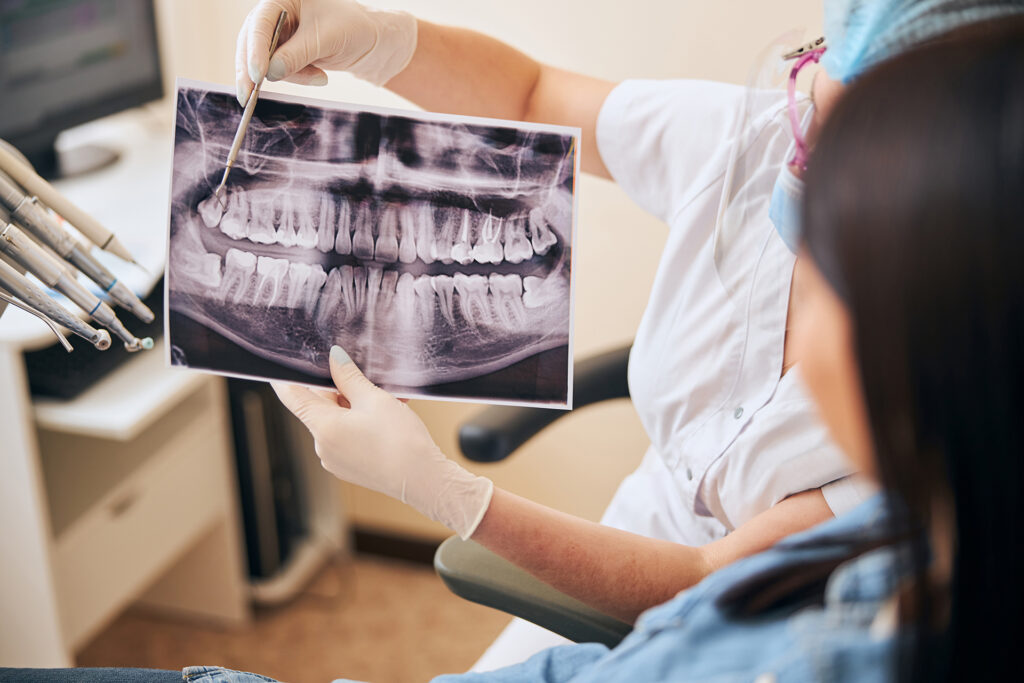 wisdom tooth extraction vs surgery X-ray