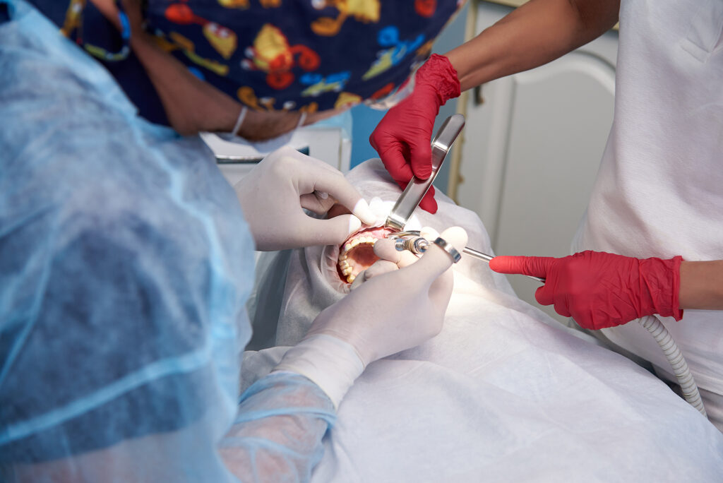 wisdom tooth extraction vs surgery procedure
