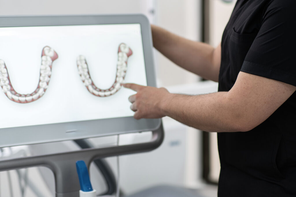 Invisalign orthodontist Singapore