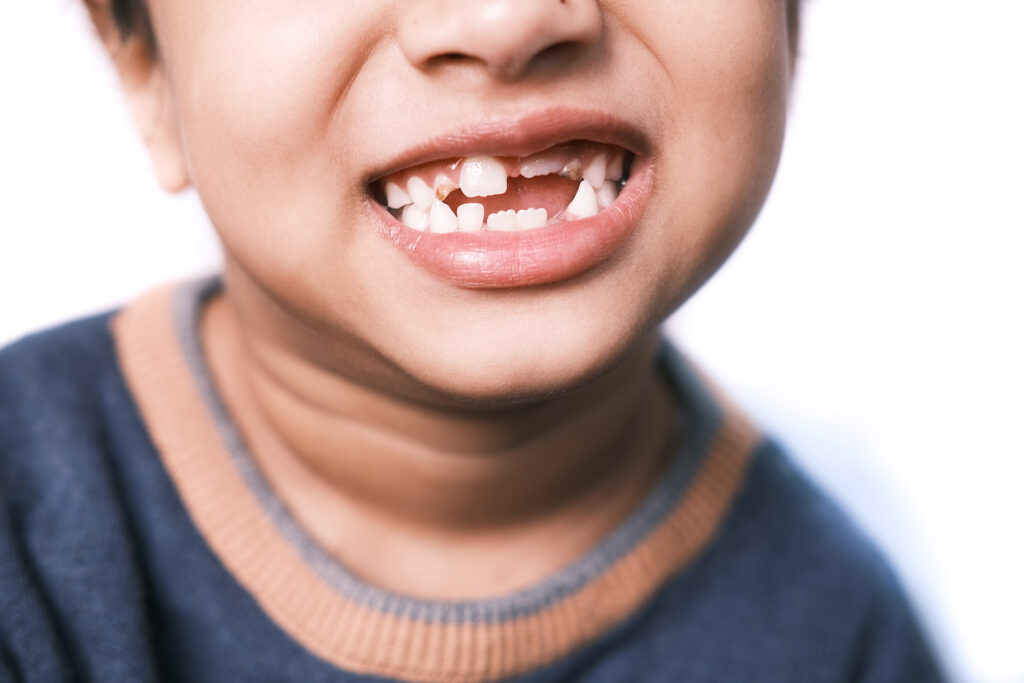 braces for kids in Singapore