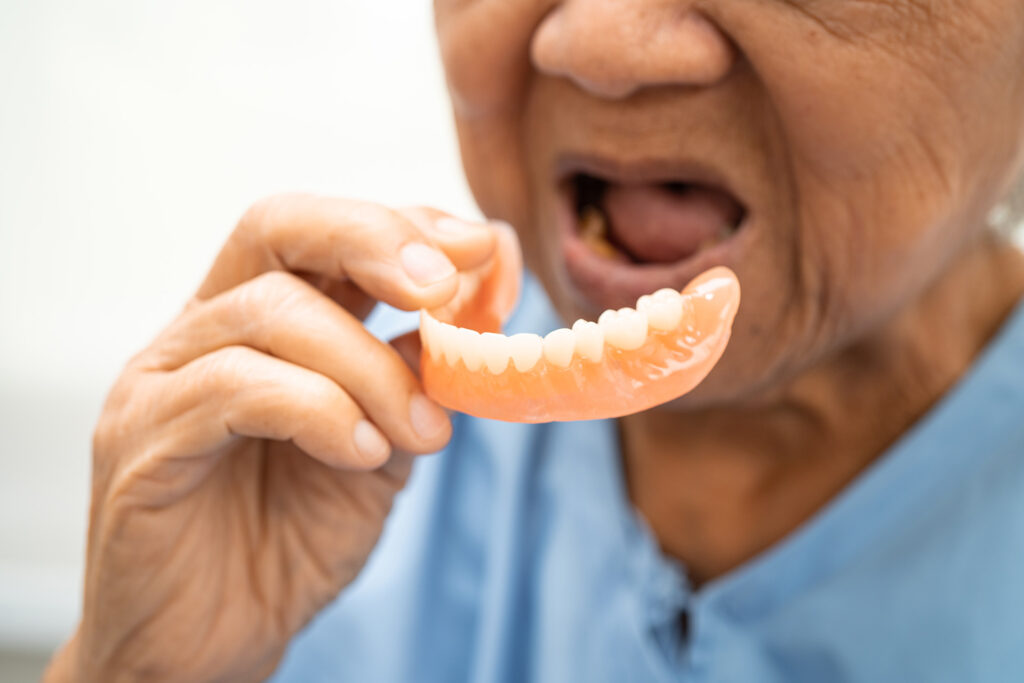 dental implants vs dentures
