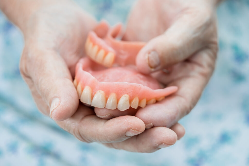 dental implants vs dentures Singapore