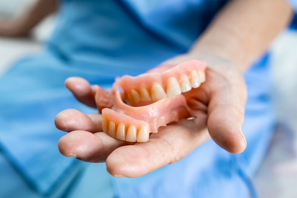 dentures vs implants in Singapore