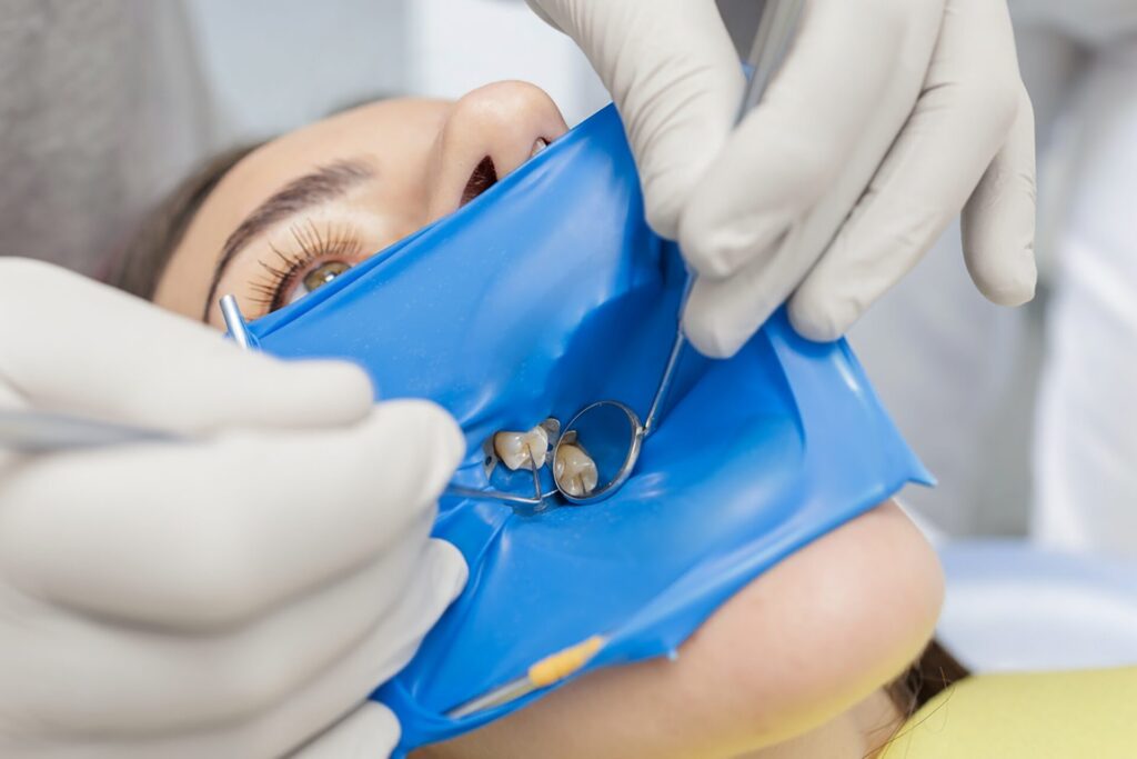 do all root canals need crowns