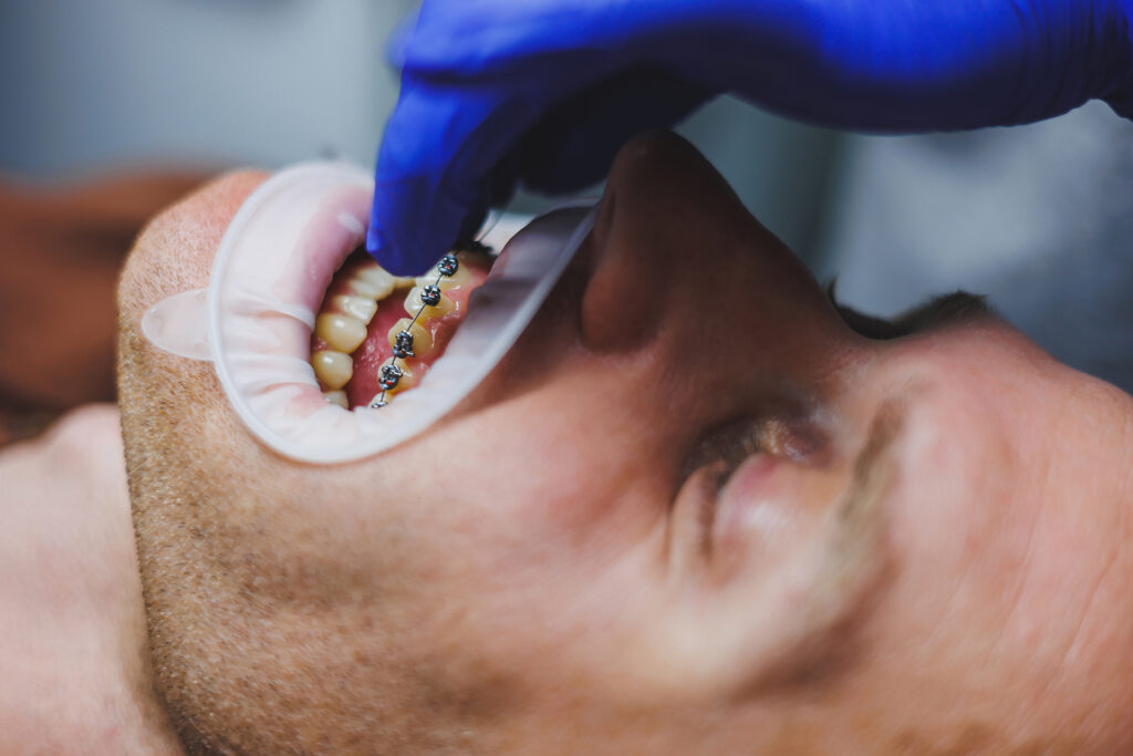orthodontic treatment cost