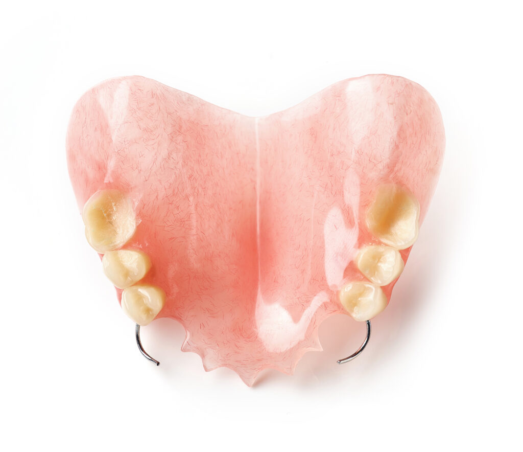 pros and cons of dental implants vs dentures