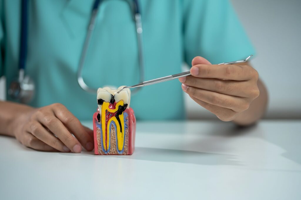 root canal and crown cost Singapore