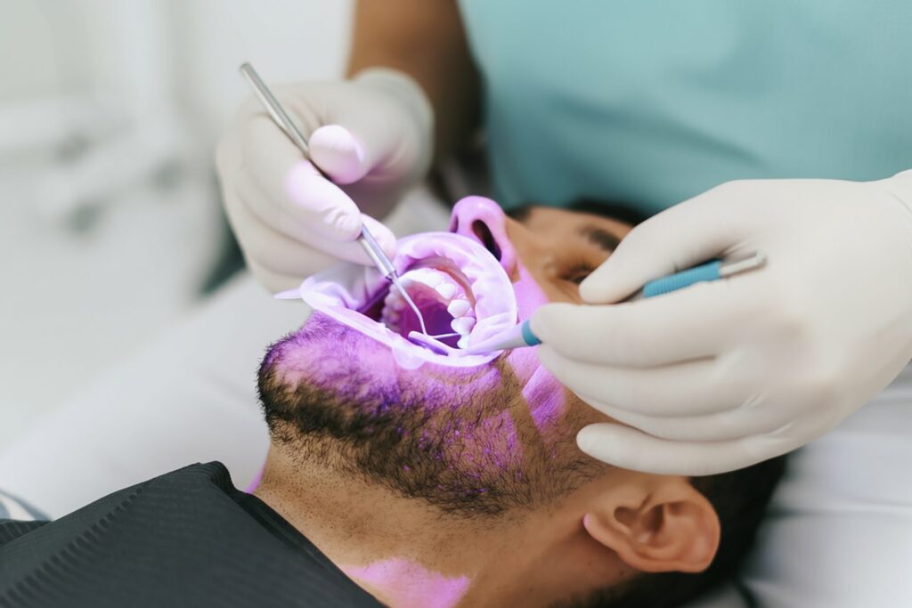 root canal crown in Singapore