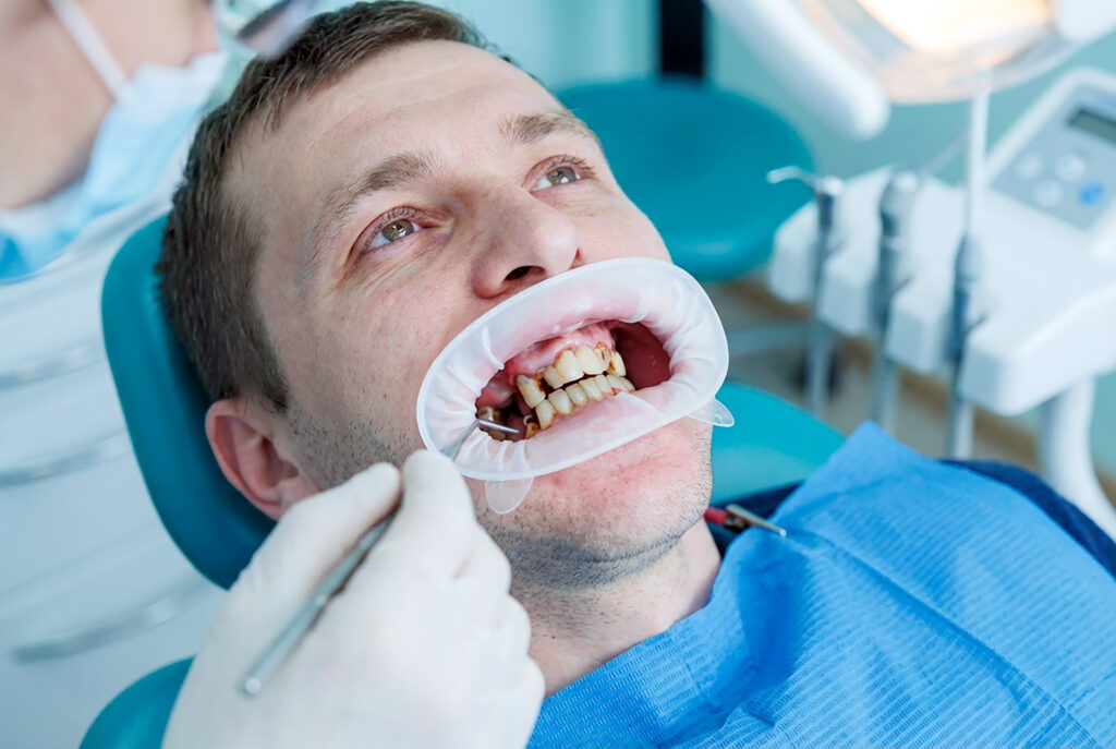 alternative treatment for gum disease