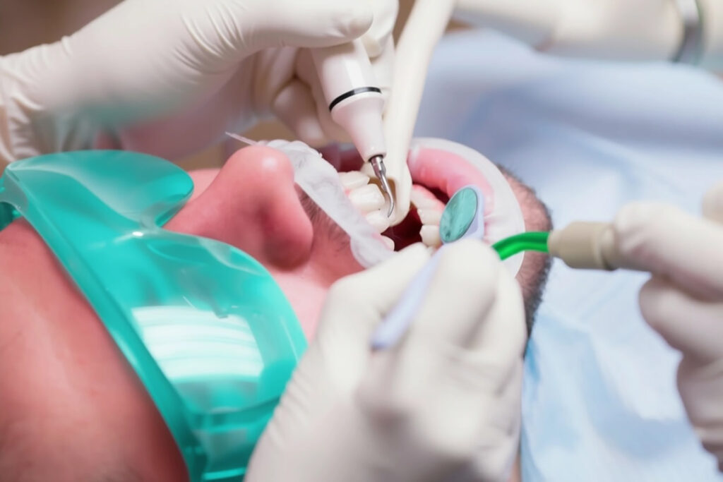 dentist teeth cleaning