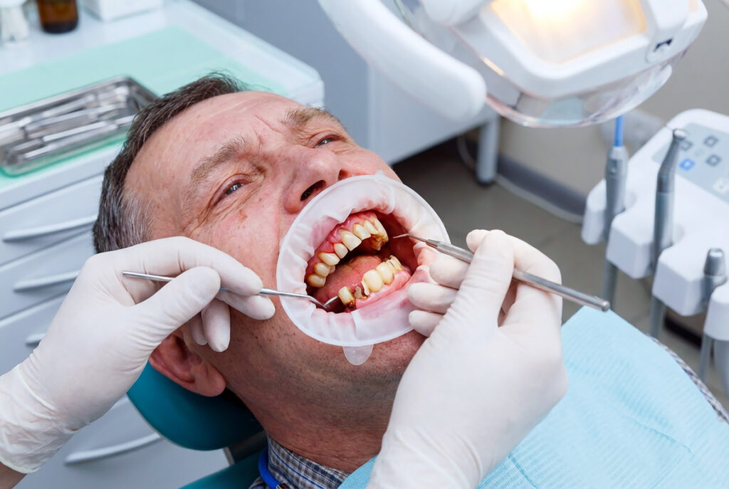 gum disease treatment cost