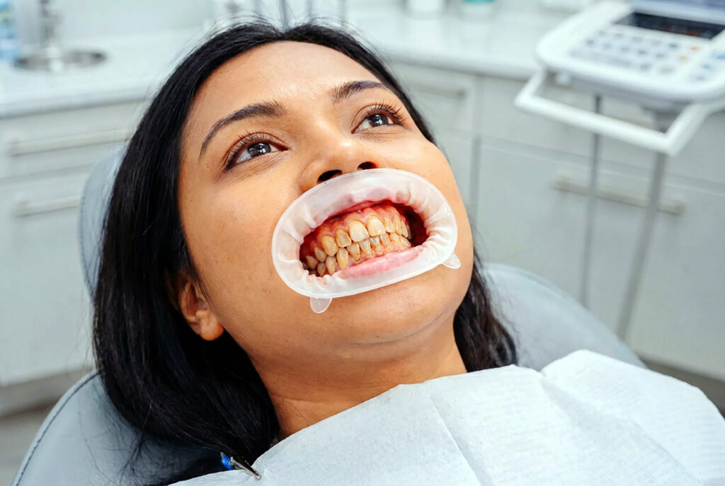 gum disease treatment cost in Singapore