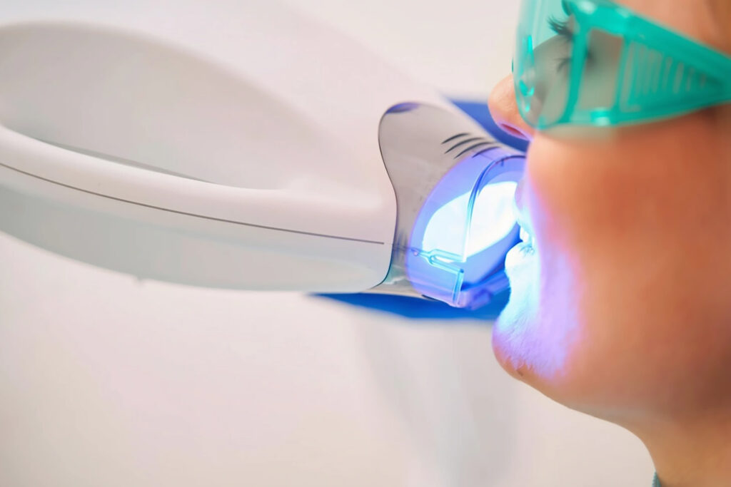 dentist near me Singapore