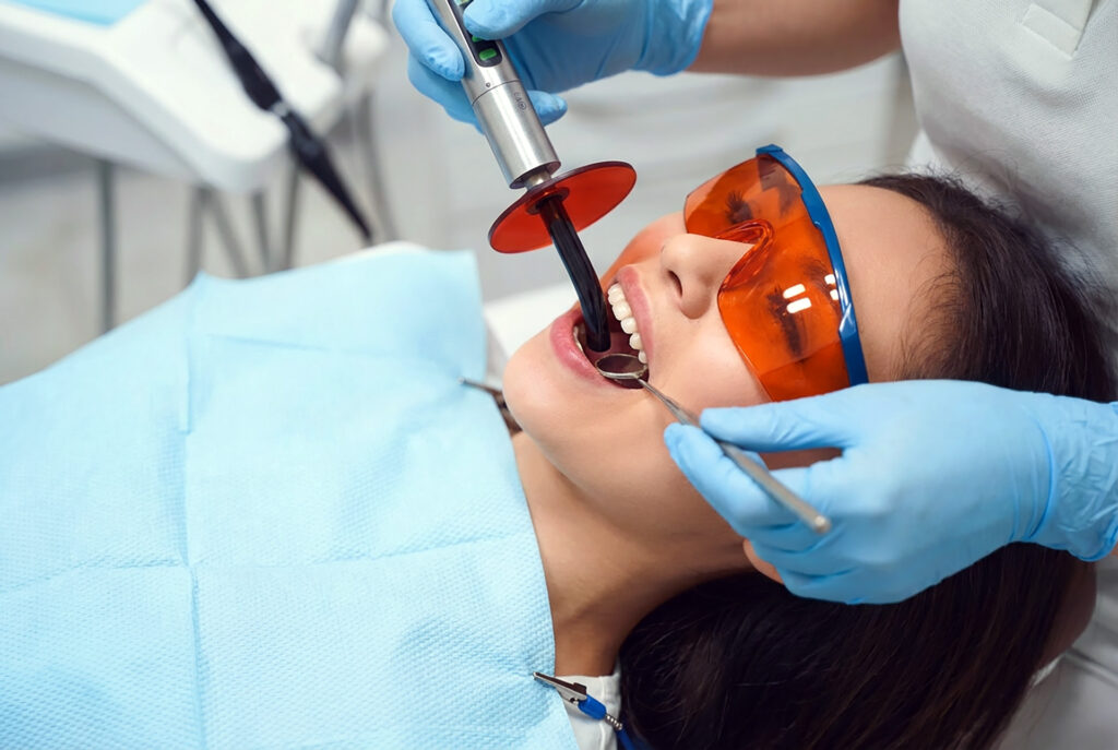 tooth-coloured composite filling