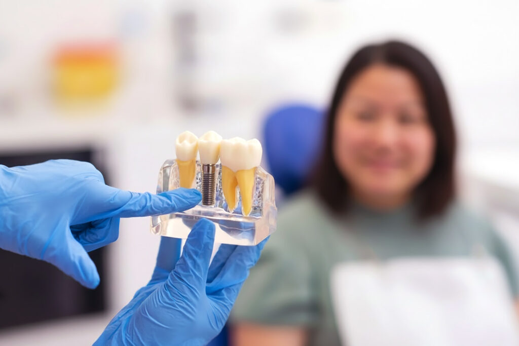 root canal treatment vs implant