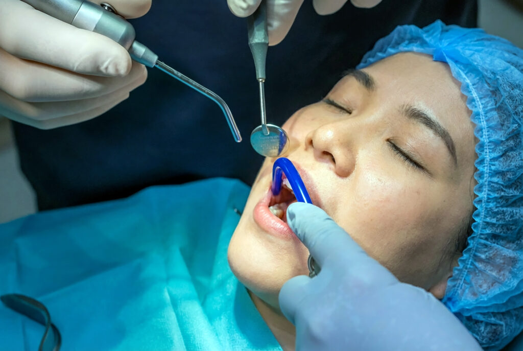 root canal vs extraction cost
