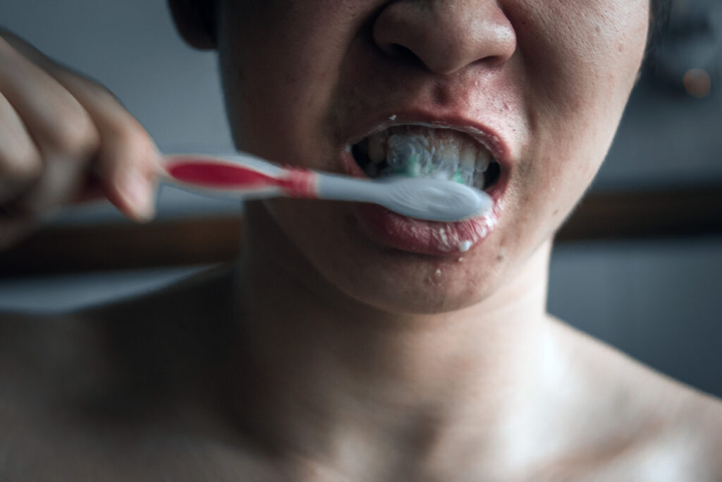 gum recession causes